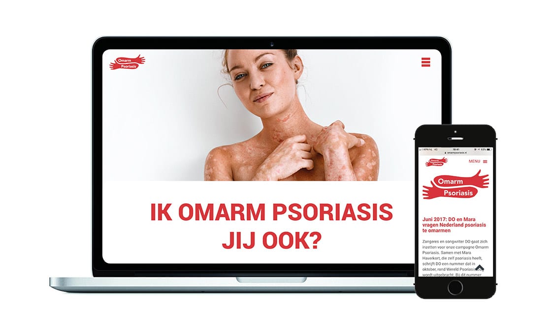 Omarm Psoriasis